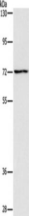 Acyl-CoA Dehydrogenase Very Long Chain antibody, TA350728, Origene, Western Blot image 