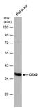 Gastrulation and brain-specific homeobox protein 2 antibody, PA5-77984, Invitrogen Antibodies, Western Blot image 