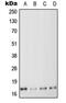 Myosin light polypeptide 6 antibody, MBS821832, MyBioSource, Western Blot image 