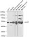 Myotilin antibody, GTX54355, GeneTex, Western Blot image 