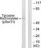 Tyrosine Hydroxylase antibody, TA312372, Origene, Western Blot image 