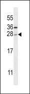 Toll Like Receptor Adaptor Molecule 2 antibody, PA5-48656, Invitrogen Antibodies, Western Blot image 