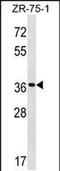Fucosyltransferase 9 antibody, PA5-48749, Invitrogen Antibodies, Western Blot image 