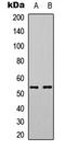 Myocyte Enhancer Factor 2A antibody, LS-C358804, Lifespan Biosciences, Western Blot image 