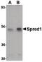 Sprouty Related EVH1 Domain Containing 1 antibody, PA5-20617, Invitrogen Antibodies, Western Blot image 