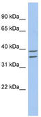 Zinc Binding Alcohol Dehydrogenase Domain Containing 2 antibody, TA333444, Origene, Western Blot image 