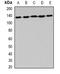 Alanyl-TRNA Synthetase antibody, LS-C482908, Lifespan Biosciences, Western Blot image 