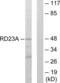 RAD23 Homolog A, Nucleotide Excision Repair Protein antibody, LS-C119594, Lifespan Biosciences, Western Blot image 