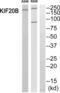 Kinesin Family Member 20B antibody, PA5-39253, Invitrogen Antibodies, Western Blot image 