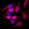 DNA Topoisomerase II Alpha antibody, MAB6540, R&D Systems, Immunofluorescence image 