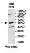 Kelch Repeat And BTB Domain Containing 4 antibody, orb78113, Biorbyt, Western Blot image 
