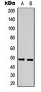 Splicing Factor 3b Subunit 4 antibody, LS-C368509, Lifespan Biosciences, Western Blot image 