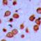Lemur Tyrosine Kinase 3 antibody, orb393096, Biorbyt, Immunohistochemistry paraffin image 