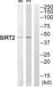 Sirtuin 2 antibody, abx015144, Abbexa, Western Blot image 