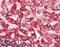 Superoxide Dismutase 2 antibody, LS-B14223, Lifespan Biosciences, Immunohistochemistry paraffin image 