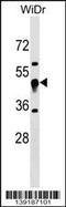 Ubiquinol-Cytochrome C Reductase Core Protein 1 antibody, 60-230, ProSci, Western Blot image 