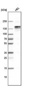 Large Tumor Suppressor Kinase 1 antibody, NBP1-86860, Novus Biologicals, Western Blot image 