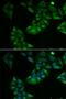 Thioredoxin 2 antibody, LS-C747687, Lifespan Biosciences, Immunofluorescence image 