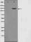 Neurotrophic Receptor Tyrosine Kinase 2 antibody, abx012018, Abbexa, Western Blot image 