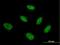 Nuclear Transcription Factor Y Subunit Beta antibody, H00004801-M03, Novus Biologicals, Immunofluorescence image 
