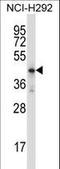 Homeobox D10 antibody, LS-B14549, Lifespan Biosciences, Western Blot image 