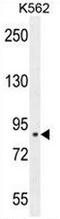 Chloride Intracellular Channel 6 antibody, AP50964PU-N, Origene, Western Blot image 