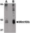 Wnt Family Member 10B antibody, PA5-20530, Invitrogen Antibodies, Western Blot image 