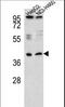 Radical S-Adenosyl Methionine Domain Containing 1 antibody, LS-C162776, Lifespan Biosciences, Western Blot image 