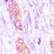 Maternal Embryonic Leucine Zipper Kinase antibody, orb224060, Biorbyt, Immunohistochemistry paraffin image 