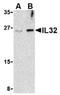 Interleukin 32 antibody, AP05618PU-N, Origene, Western Blot image 