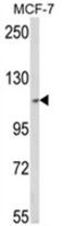 Mtr4 Exosome RNA Helicase antibody, AP18197PU-N, Origene, Western Blot image 