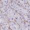 Transient Receptor Potential Cation Channel Subfamily V Member 6 antibody, NBP2-32372, Novus Biologicals, Immunohistochemistry frozen image 