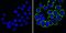 ERBB2 antibody, MA5-14057, Invitrogen Antibodies, Immunofluorescence image 