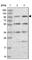 Kinesin Family Member 18A antibody, HPA039312, Atlas Antibodies, Western Blot image 