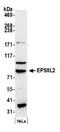 EPS8 Like 2 antibody, NB100-97850, Novus Biologicals, Western Blot image 