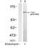 Tyrosine Kinase 2 antibody, GTX50206, GeneTex, Western Blot image 