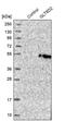 Glycosyltransferase 8 Domain Containing 2 antibody, PA5-55458, Invitrogen Antibodies, Western Blot image 