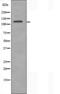 CAP-Gly Domain Containing Linker Protein Family Member 4 antibody, orb226393, Biorbyt, Western Blot image 