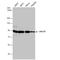 Amyloid Beta Precursor Like Protein 2 antibody, NBP1-32814, Novus Biologicals, Western Blot image 