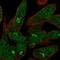 Ubiquitin Specific Peptidase 33 antibody, HPA005719, Atlas Antibodies, Immunofluorescence image 