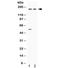 Ceruloplasmin antibody, R31856, NSJ Bioreagents, Western Blot image 