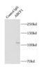 ATP-binding cassette sub-family F member 1 antibody, FNab00040, FineTest, Immunoprecipitation image 