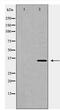 Heme Oxygenase 2 antibody, TA347887, Origene, Western Blot image 