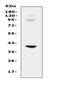 Insulin Like Growth Factor Binding Protein 3 antibody, A00435-3, Boster Biological Technology, Western Blot image 