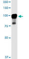 Microtubule Affinity Regulating Kinase 2 antibody, LS-C197132, Lifespan Biosciences, Western Blot image 