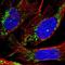 Thymidylate kinase antibody, NBP1-91851, Novus Biologicals, Immunofluorescence image 