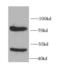 Interleukin 10 Receptor Subunit Alpha antibody, FNab04213, FineTest, Western Blot image 