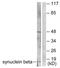 Synuclein Beta antibody, LS-B7627, Lifespan Biosciences, Western Blot image 