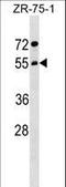 Archain 1 antibody, LS-C159103, Lifespan Biosciences, Western Blot image 