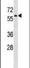 Protein Kinase AMP-Activated Catalytic Subunit Alpha 1 antibody, PA5-14026, Invitrogen Antibodies, Western Blot image 